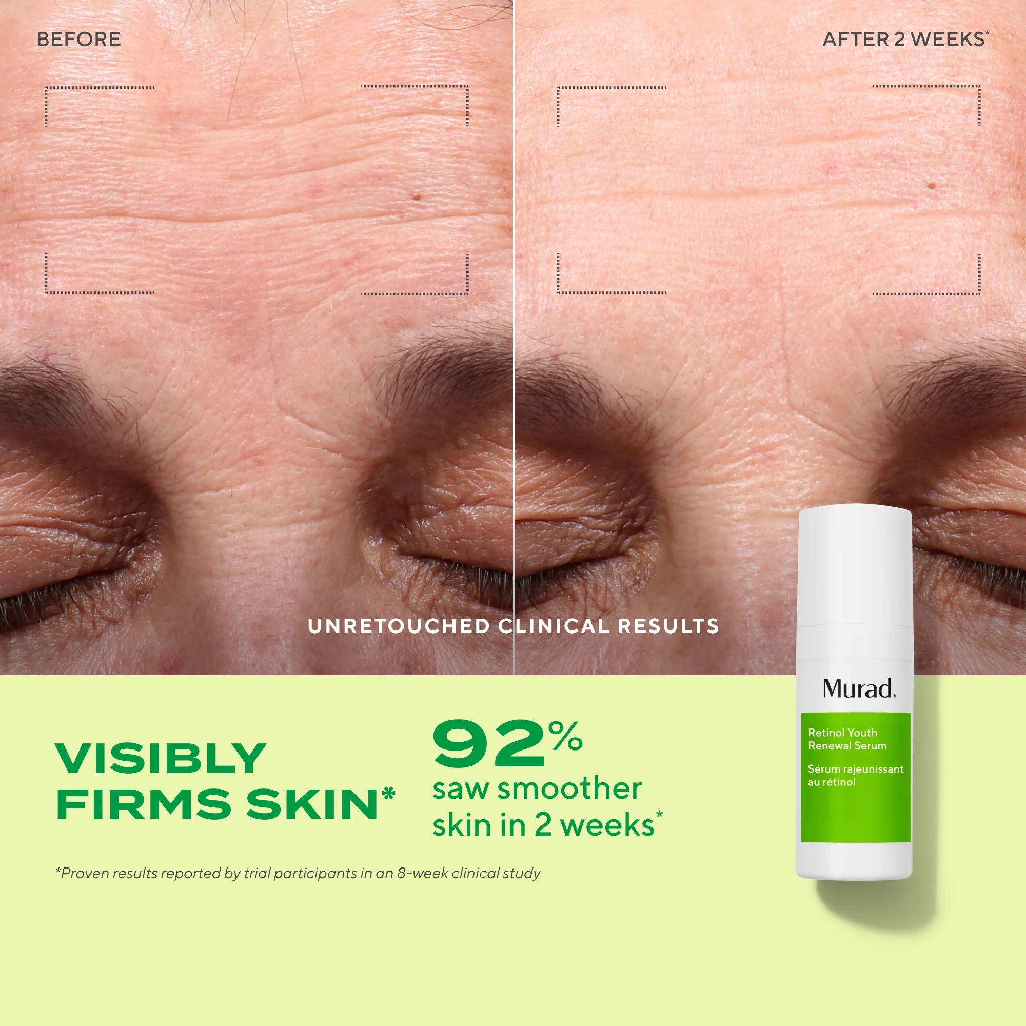 3-Piece Retinol Revival Regimen - Image 2