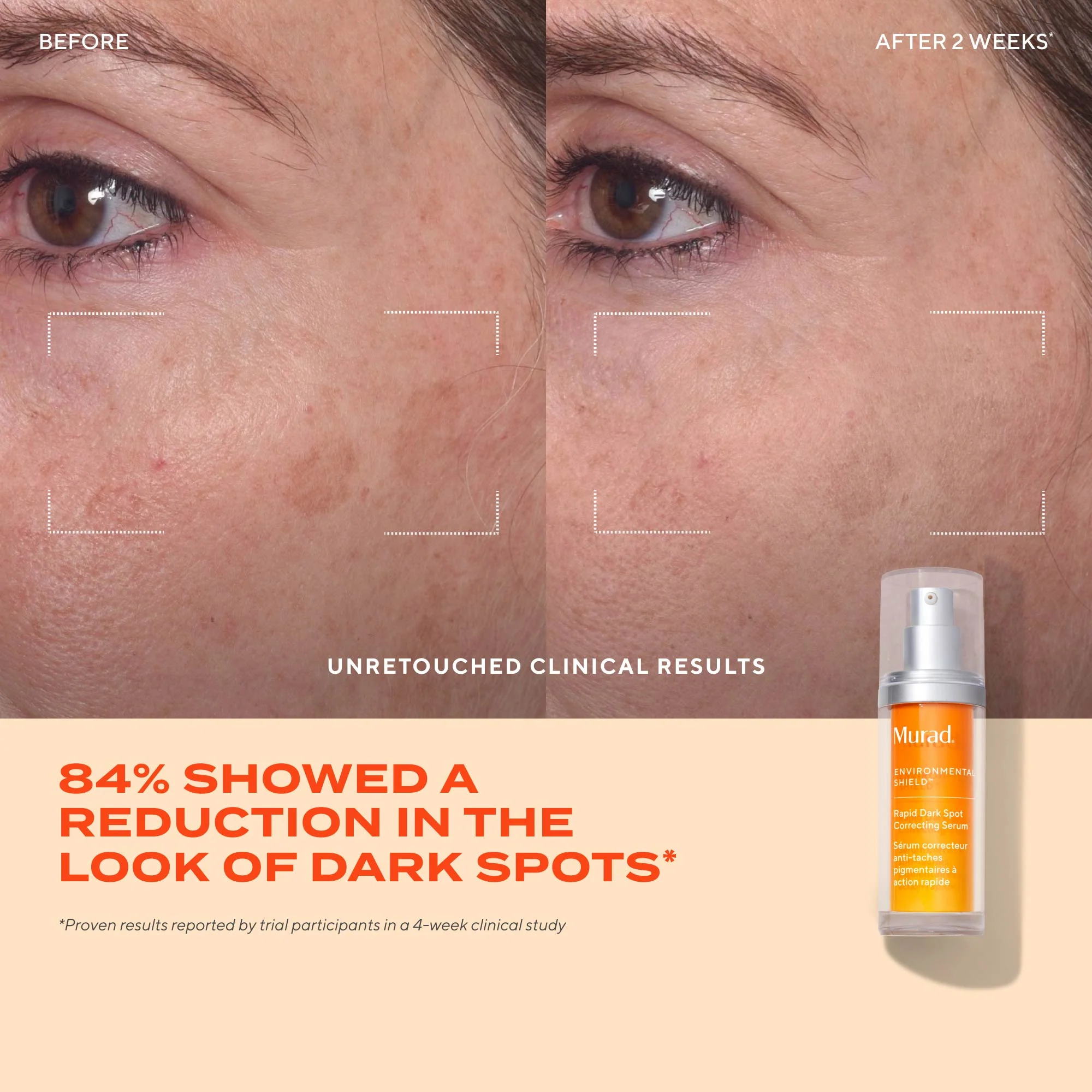 Rapid Dark Spot Correcting Serum Travel Size - Image 3