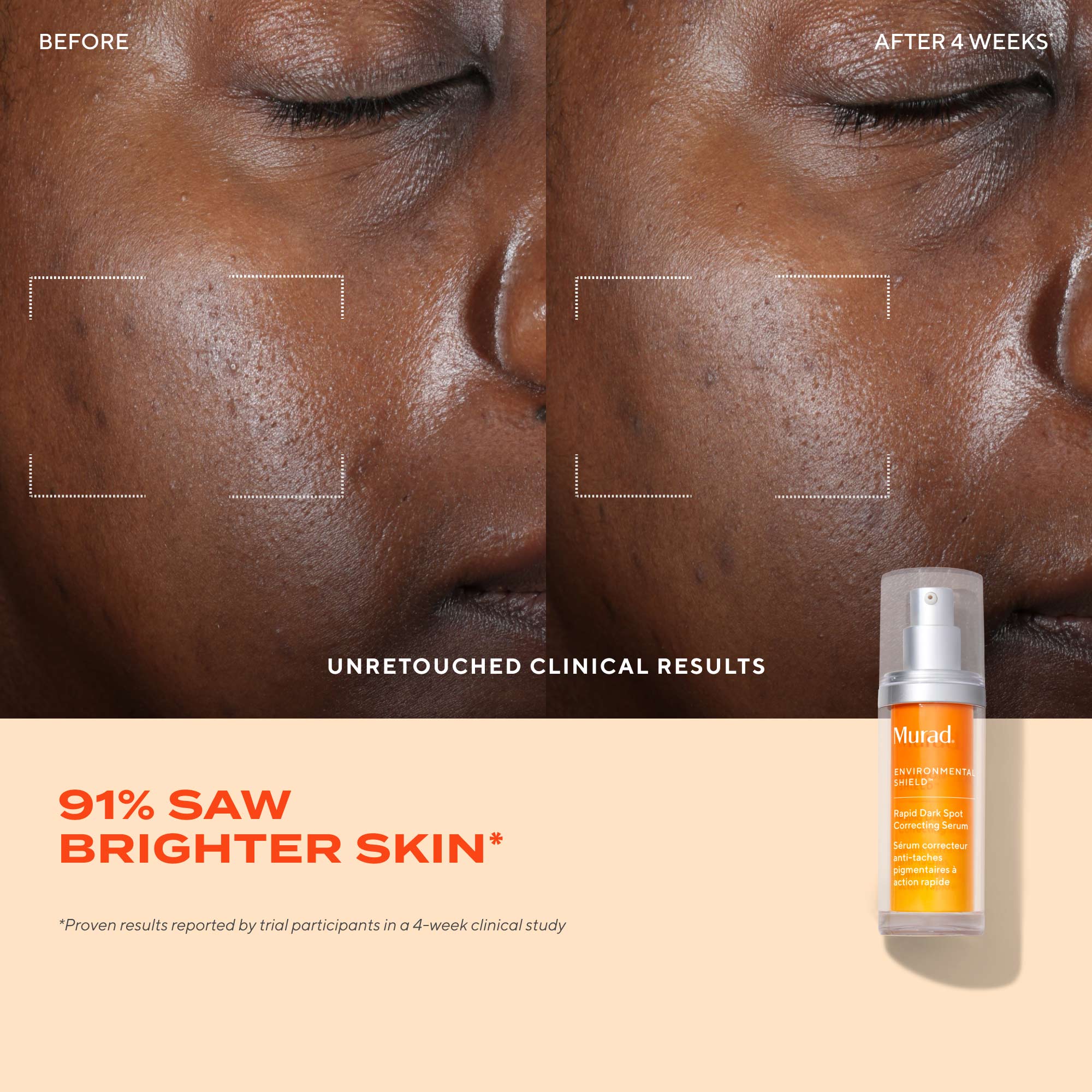 Rapid Dark Spot Correcting Serum Travel Size - Image 4