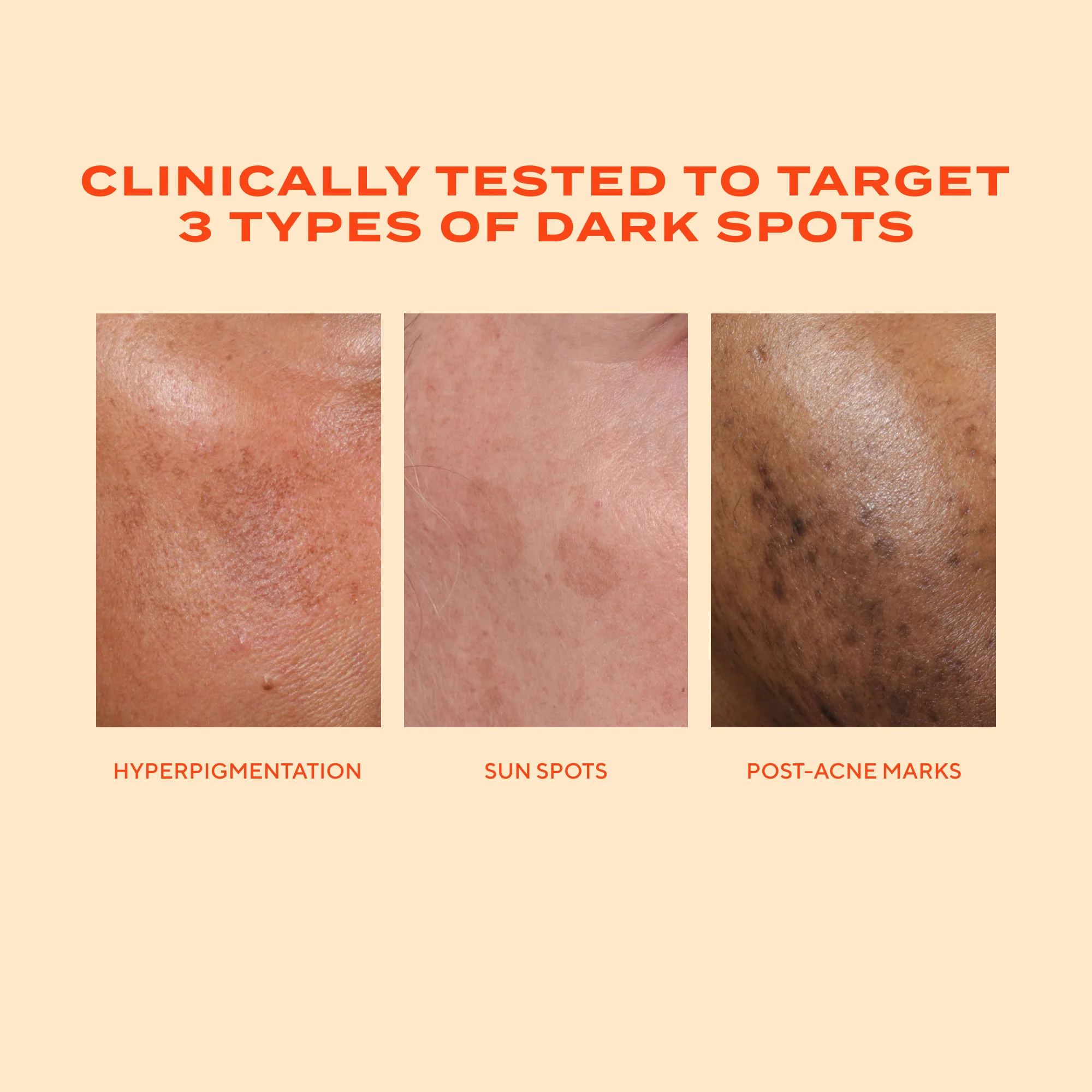 Rapid Dark Spot Correcting Serum Travel Size - Image 9