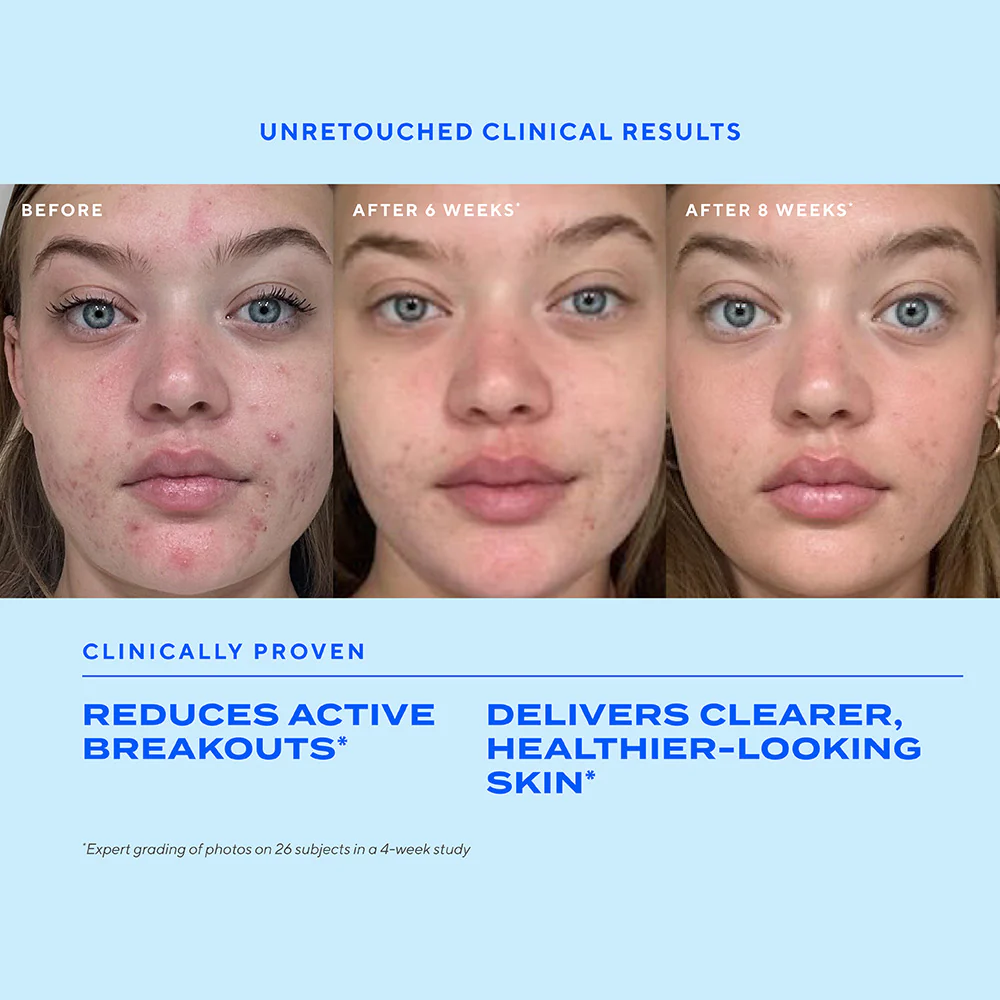 Biome-Balancing Clear & Prevent Acne Treatment Serum - Image 3