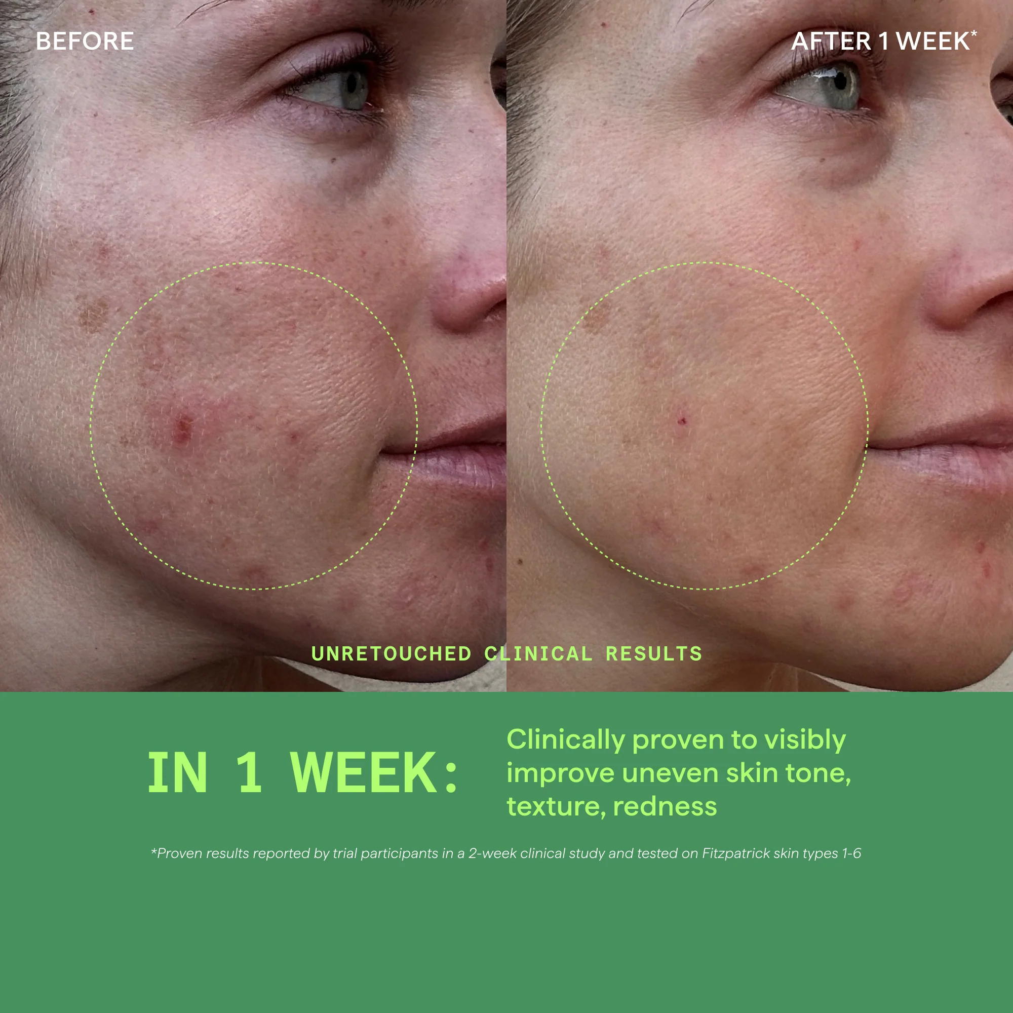 Biome-Balancing Calm & Recover Cream - Image 3