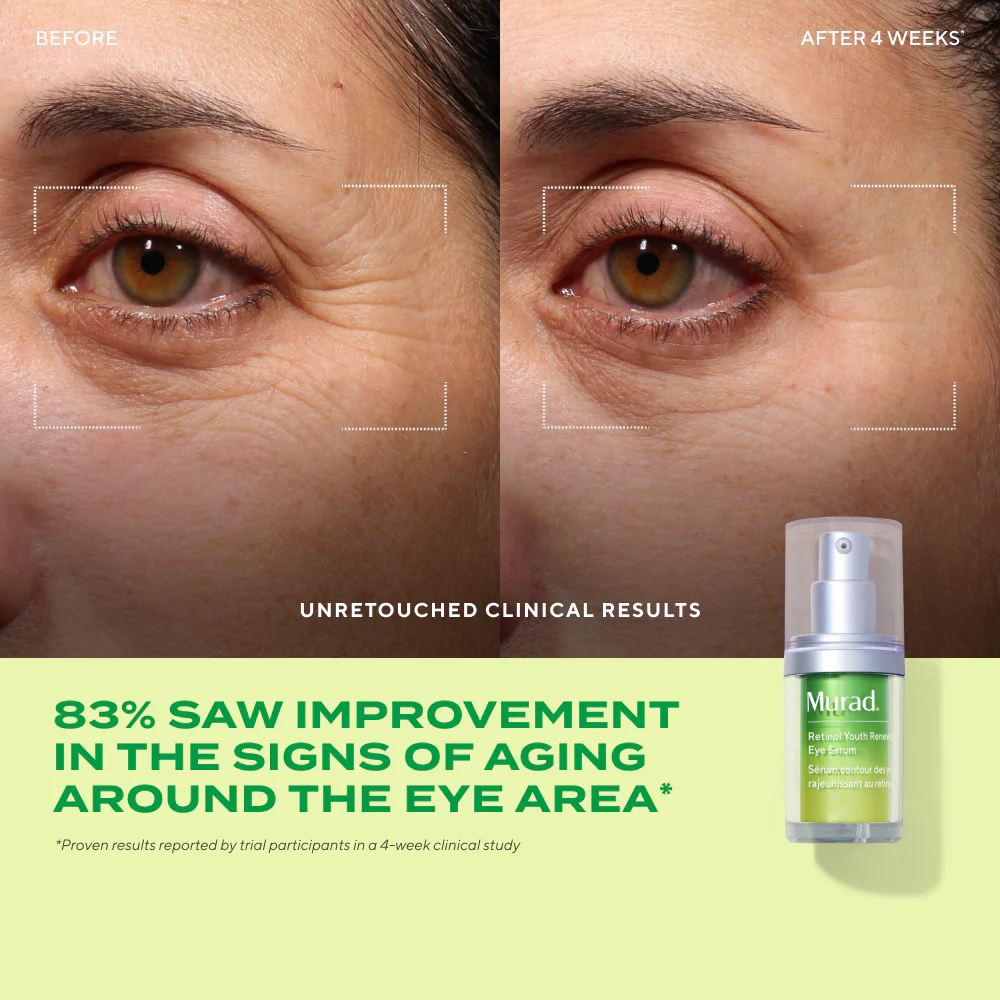 Derm Clinic: Target Eye Wrinkles Value Set - Image 3