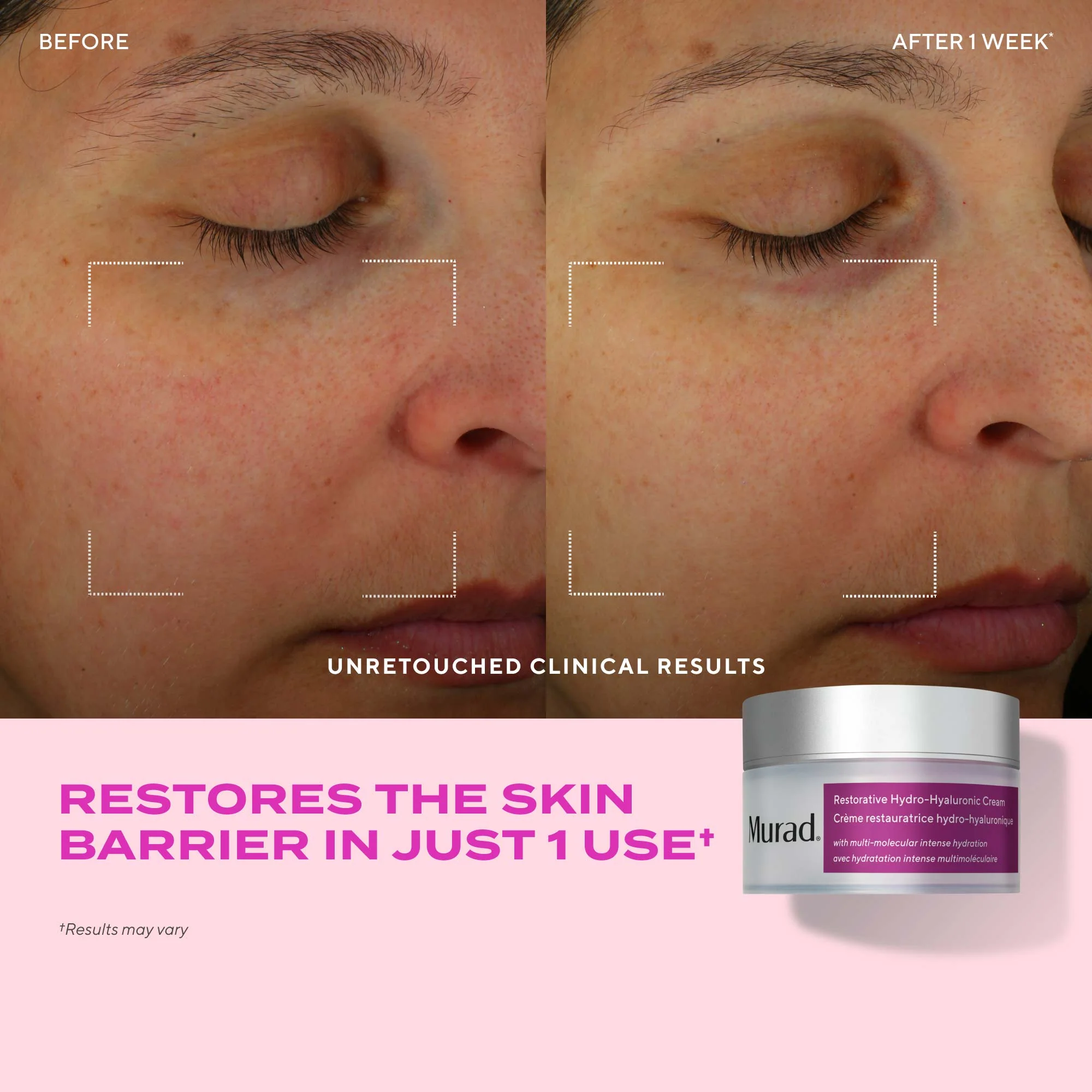 Restorative Hydro-Hyaluronic Cream - Image 4