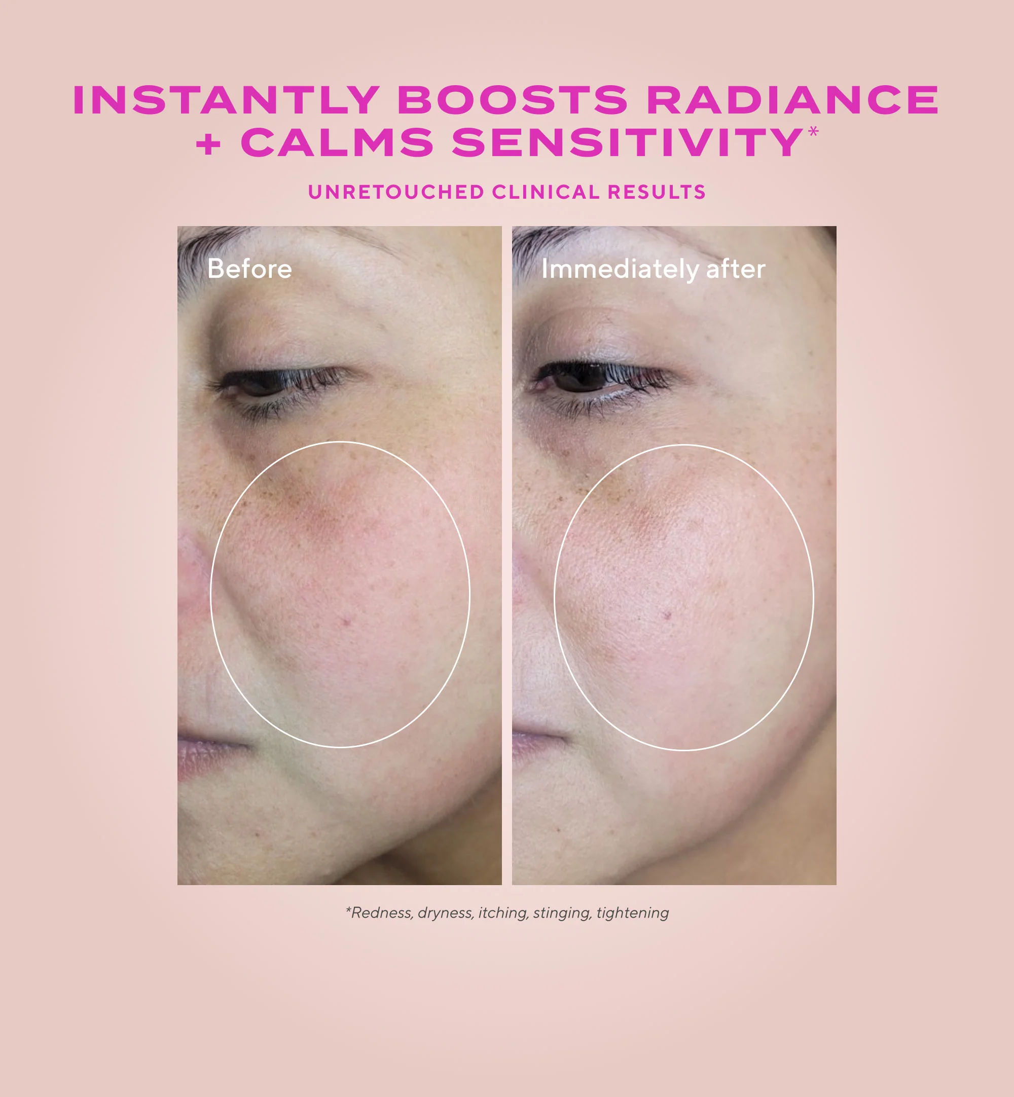 Gentle Glycolic Acid Resurfacing Serum for Sensitive Skin - Image 3