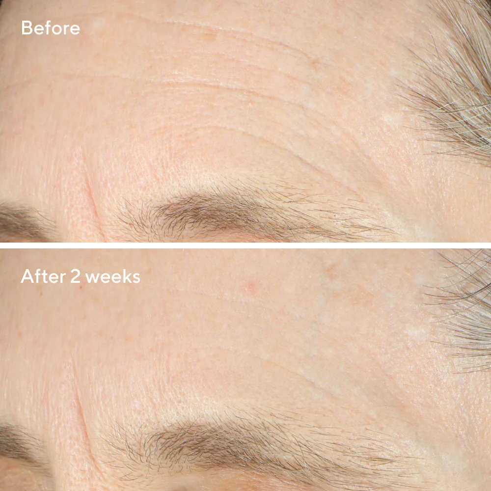 Intense Recovery Cream - Image 3
