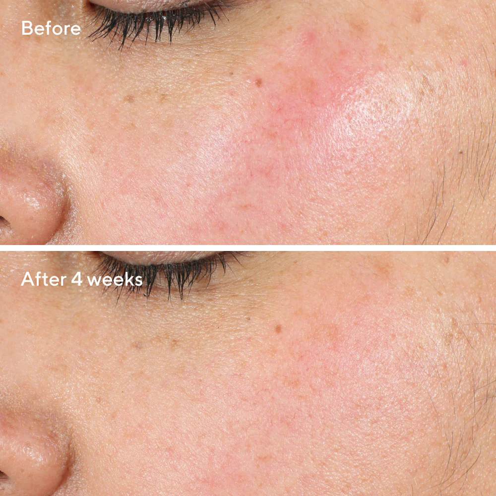 Intense Recovery Cream - Image 4