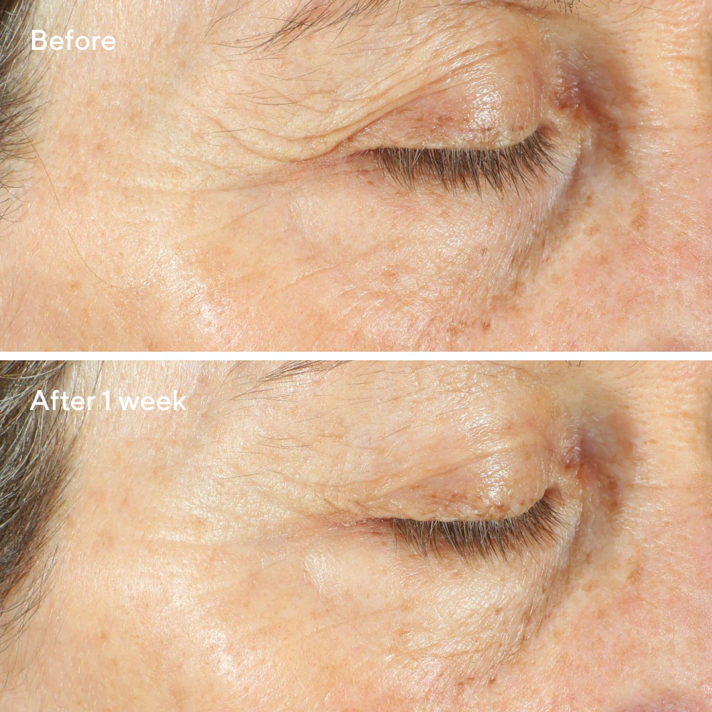 Intense Recovery Cream - Image 5