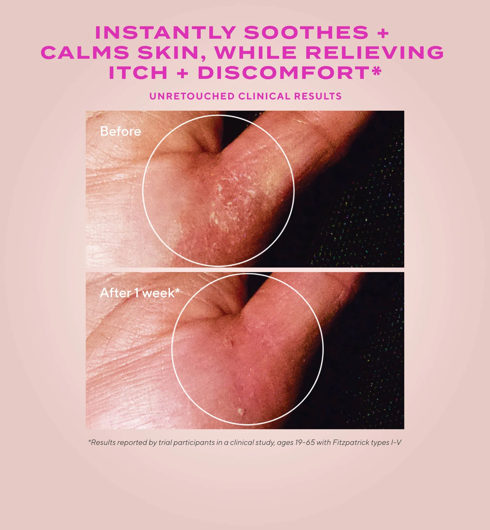 Quick Relief Colloidal Oatmeal Treatment - Image 3