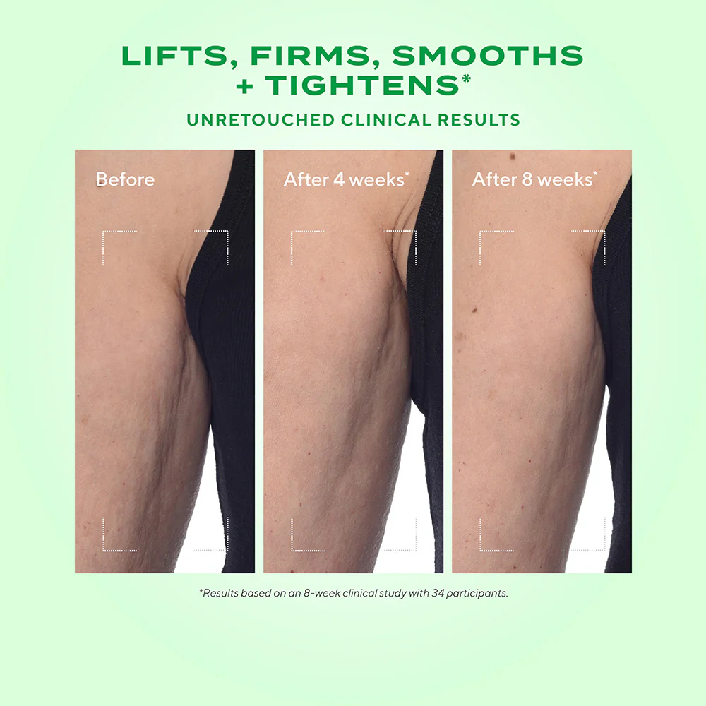 Retinal ReSculpt Body Treatment - Image 6