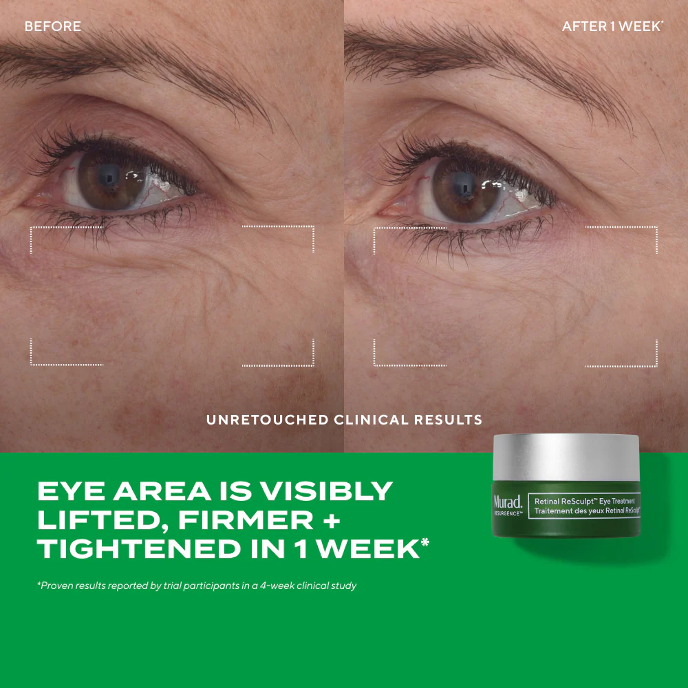 Retinal ReSculpt Eye Lift Treatment - Image 3