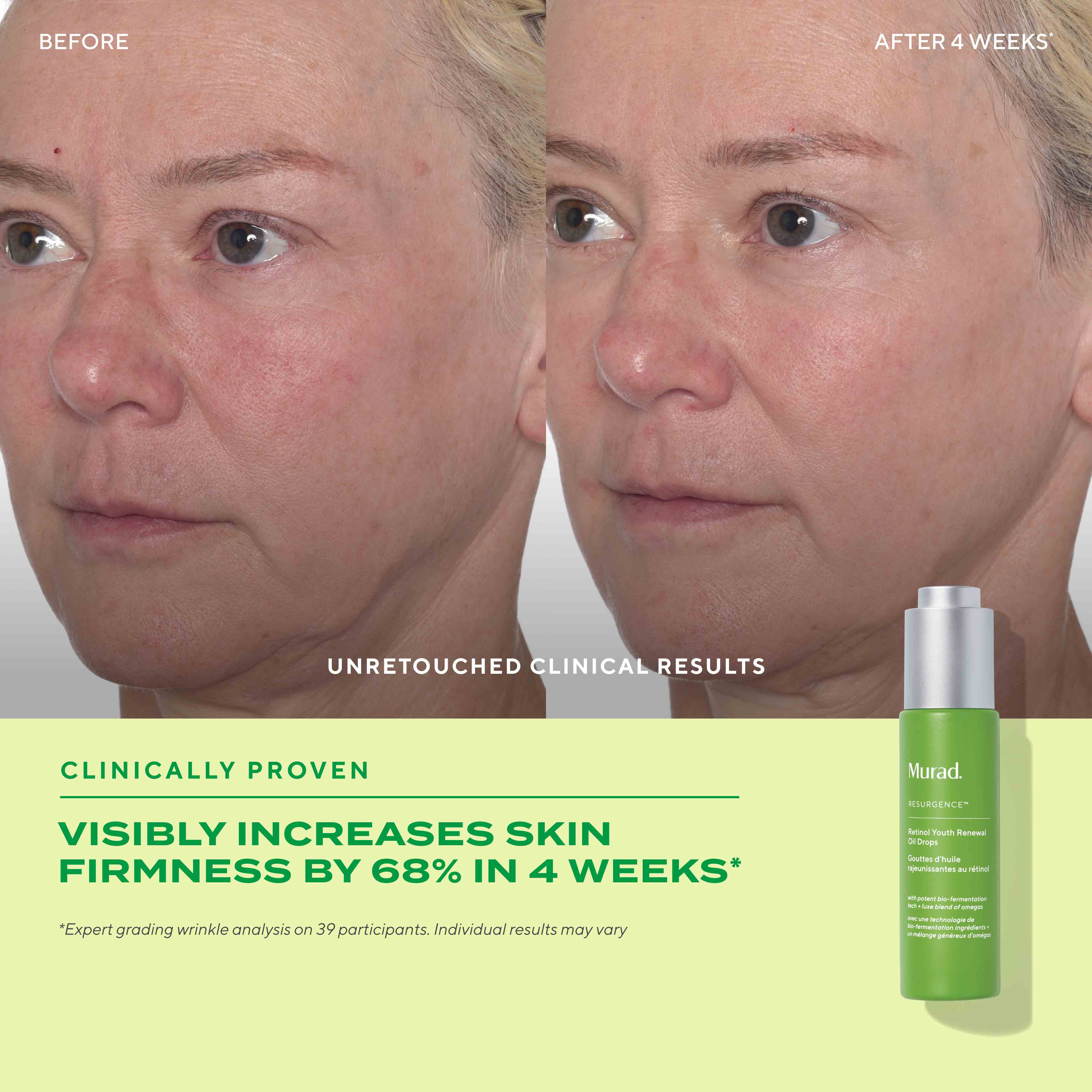 Retinol Youth Renewal Face Oil Drops - Image 8