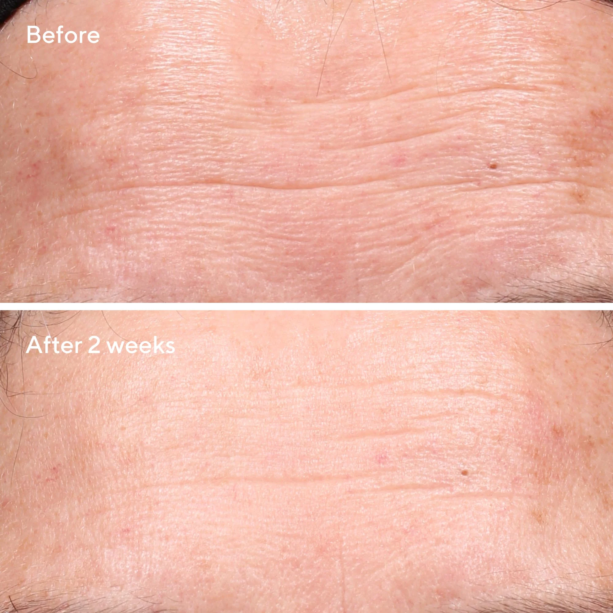 Retinol Youth Renewal Serum Larger Size - Image 3
