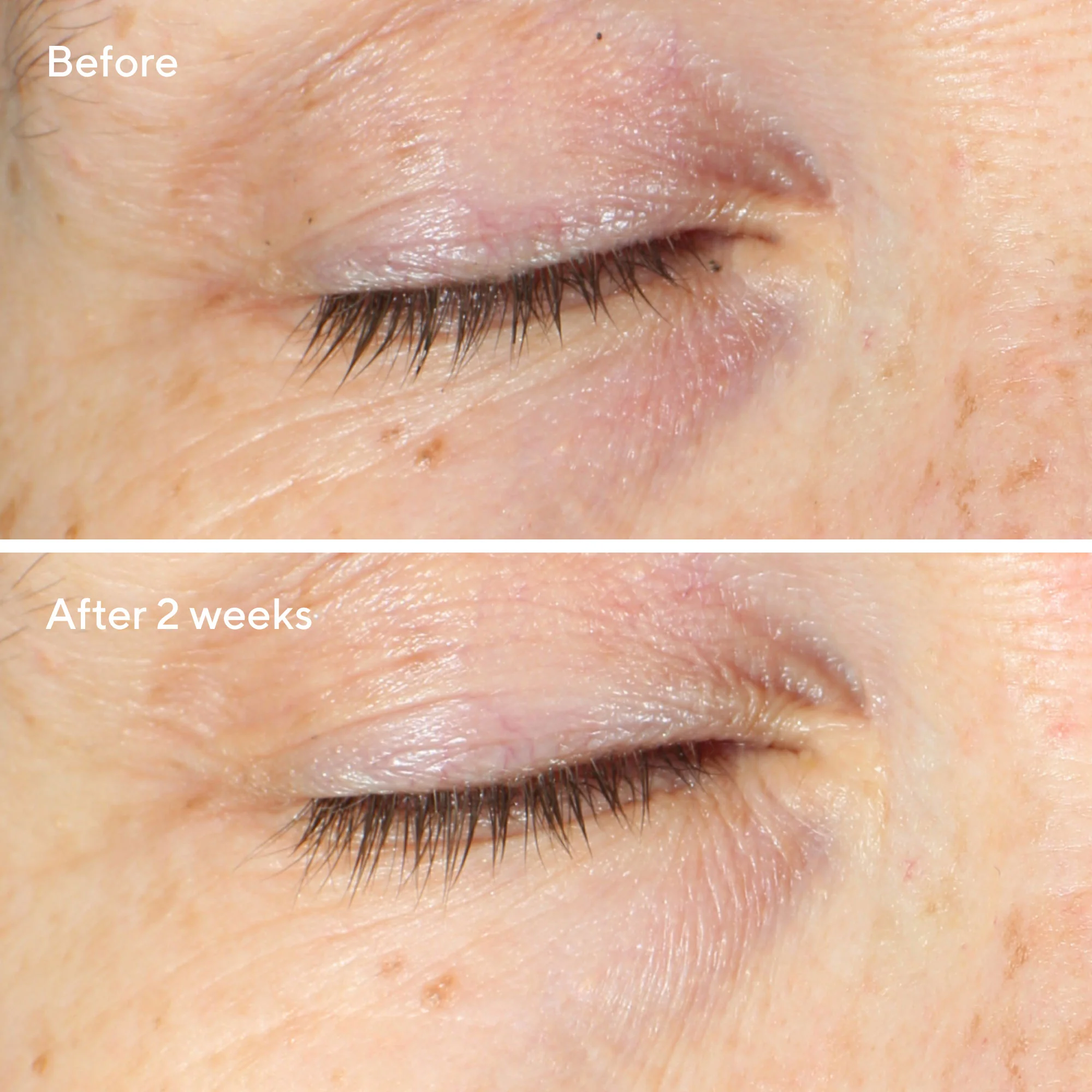Vita-C Eyes Dark Circle Corrector - Image 4