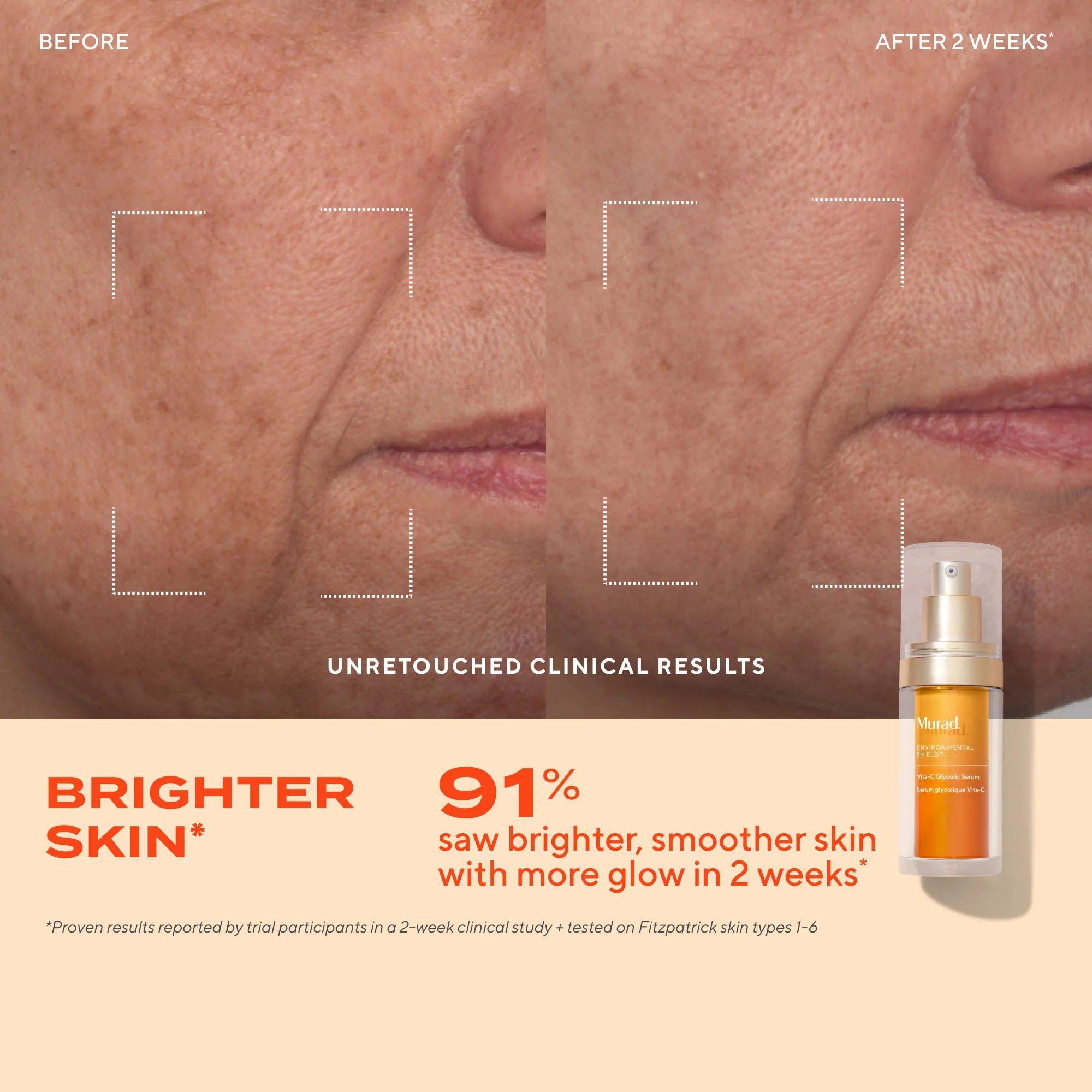 Vita-C Glycolic Serum Refill Savings Bundle - Image 4